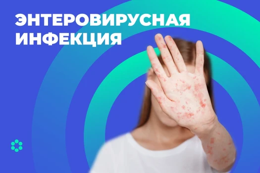 Энтеровирусная инфекция